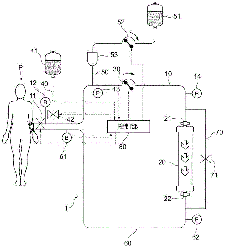 血液净化装置及其控制方法与流程