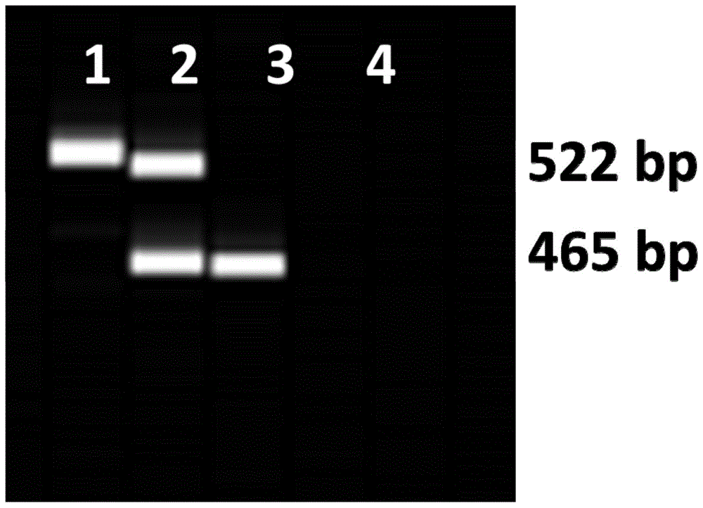 可区分烟草抗斑萎病位点RTSW纯合杂合基因型的共显性标记引物、区分方法及其应用与流程