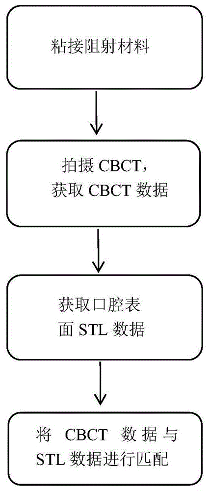 CBCT数据与STL数据精准匹配的方法与流程