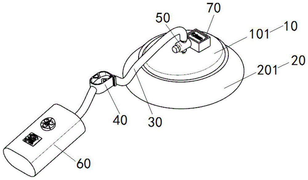 漏斗胸矫正器的制作方法