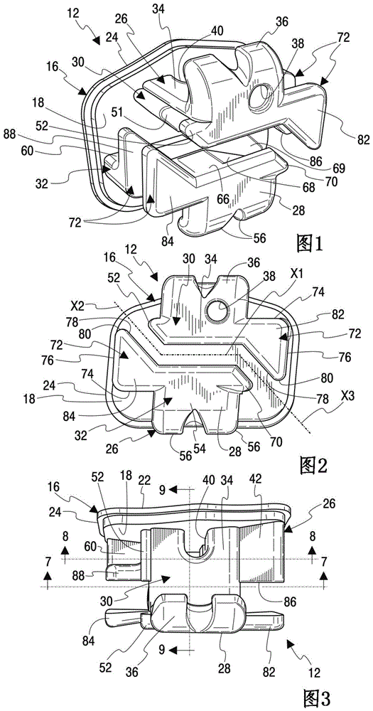 具有固定的绑定突片的正畸托槽的制作方法