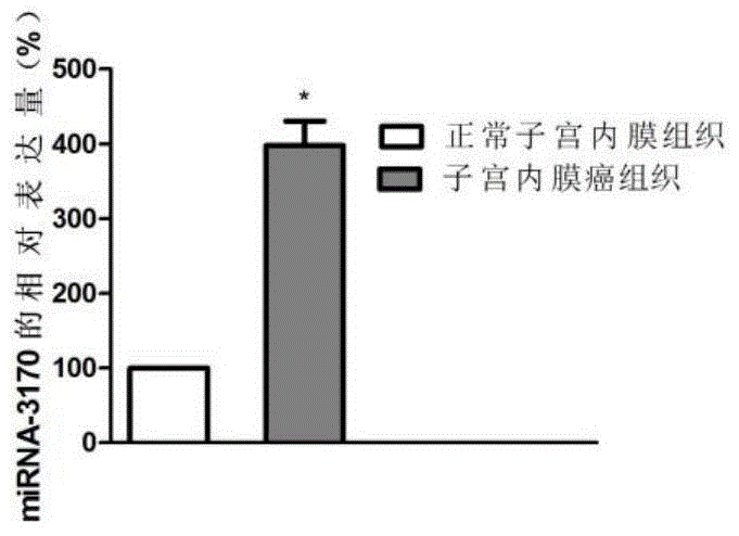 子宫内膜癌的诊疗标记物的制作方法