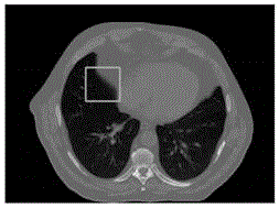 基于CT值和自动提取呼吸状态的方法与流程