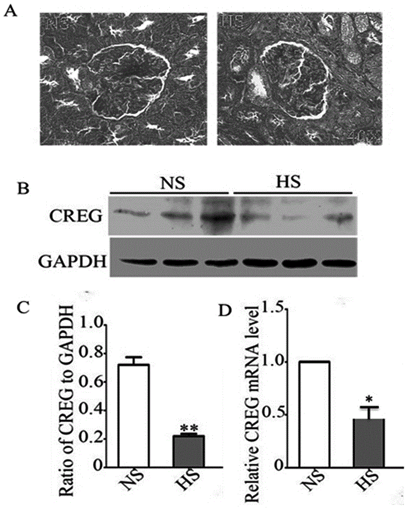 CREG蛋白保护高盐诱导的肾脏损伤的医药用途的制作方法