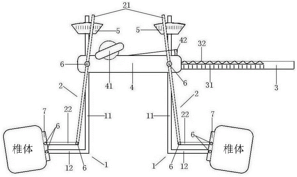 新型的椎间测量器的制作方法