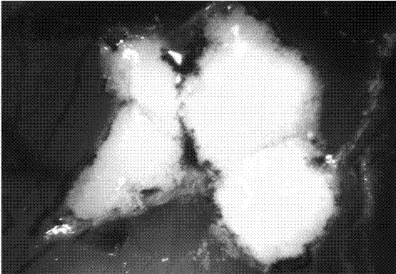一种肝癌患者来源鸡胚绒毛尿囊膜M-PDX模型构建方法与流程