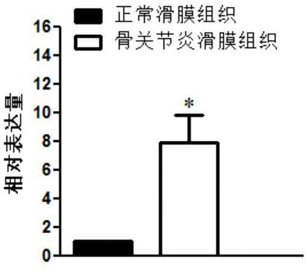 AGAP9在制备诊断骨关节炎的产品中的应用的制作方法