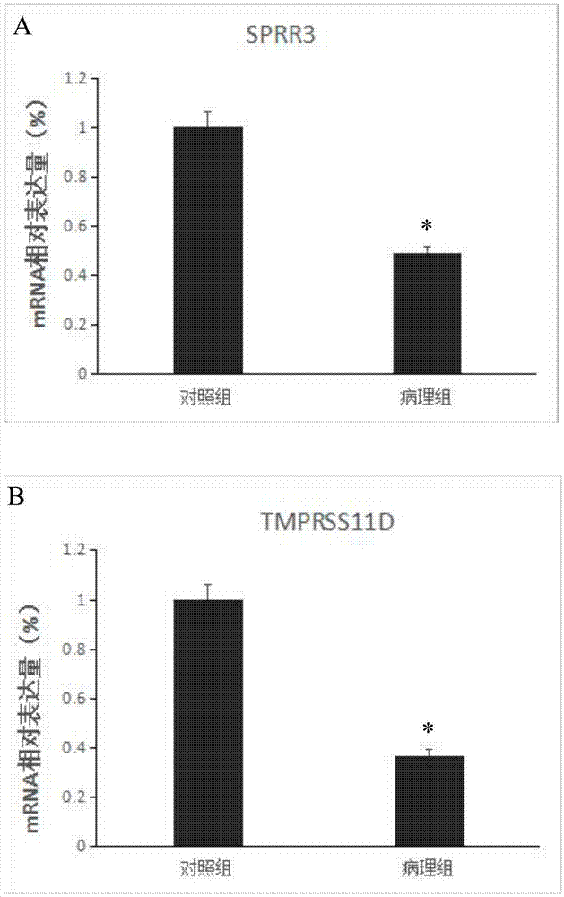 SPRR3和/或TMPRSS11D作为骨性关节炎诊治标志物的用途的制作方法