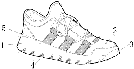 一种具有矫正功能的跑鞋的制作方法