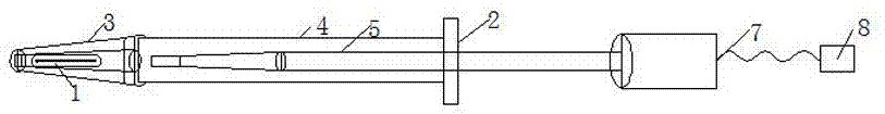 一种治疗白内障用智能截囊器的制作方法