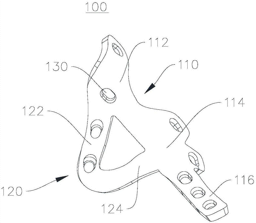 一种双柱翼状接骨板及双柱翼状接骨装置的制作方法