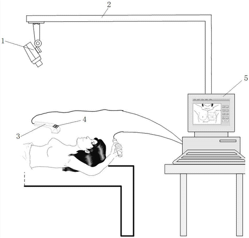 乳腺电阻抗扫描成像手持式检测探头体表定位系统及方法与流程