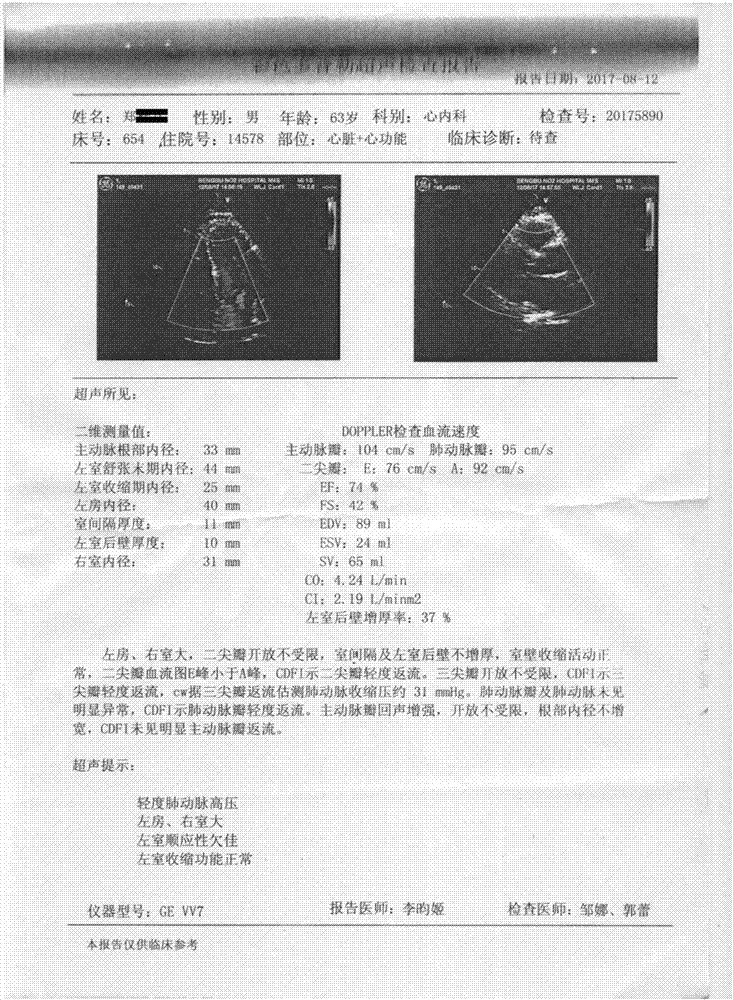 一种治疗冠心病的药组和治疗冠心病的药组原理及其制作剂型的制作方法