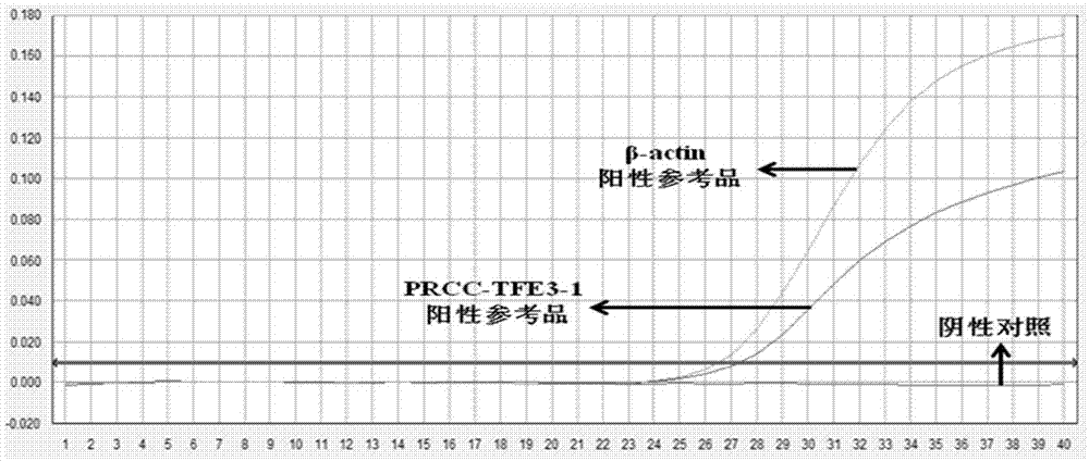 检测样本中PRCC-TFE3融合基因的寡核苷酸、方法和试剂盒与流程