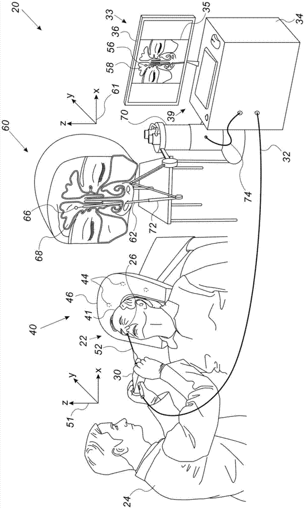 使用虚拟装置和物理3D模型以显现医疗装置在患者器官中的导航的制作方法