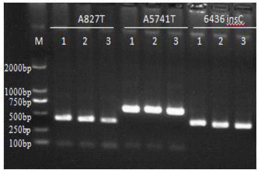 检测DMD A827T、DMD A5741T和DMD 6436 insC位点突变的引物和方法与流程