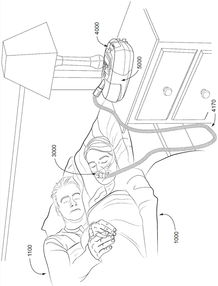 患者接口的制作方法