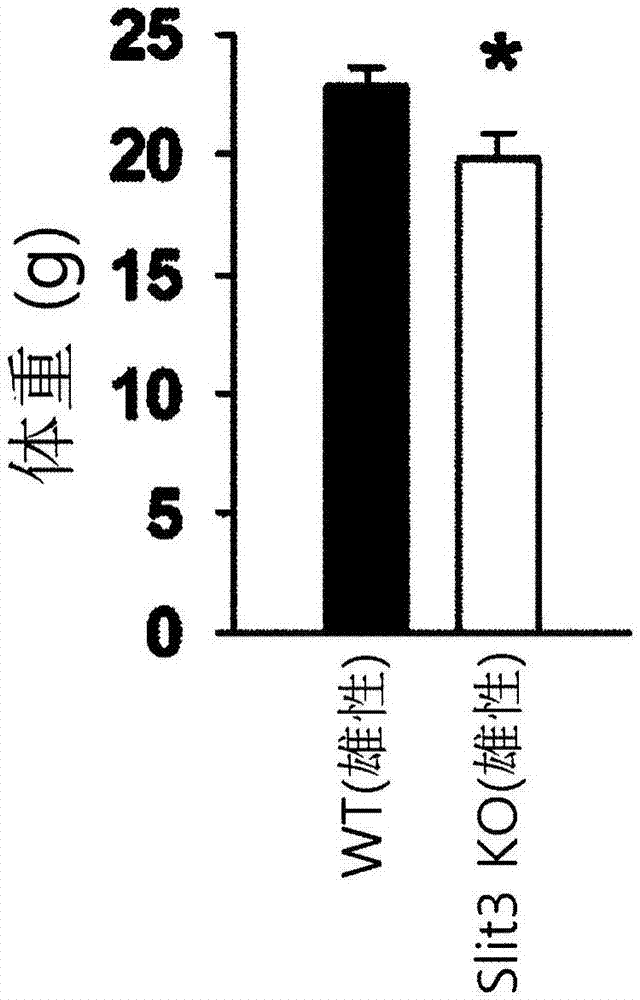 使用SLIT－ROBO系统的预防或治疗肌肉减少症的组合物的制作方法