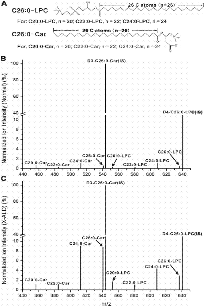 C26:0-酰基肉碱作为脑型X-ALD疾病筛查标志物的用途的制作方法