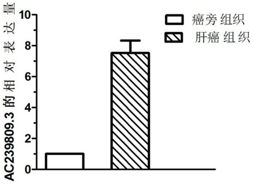 一种用于肝癌诊断的生物标志物的制作方法