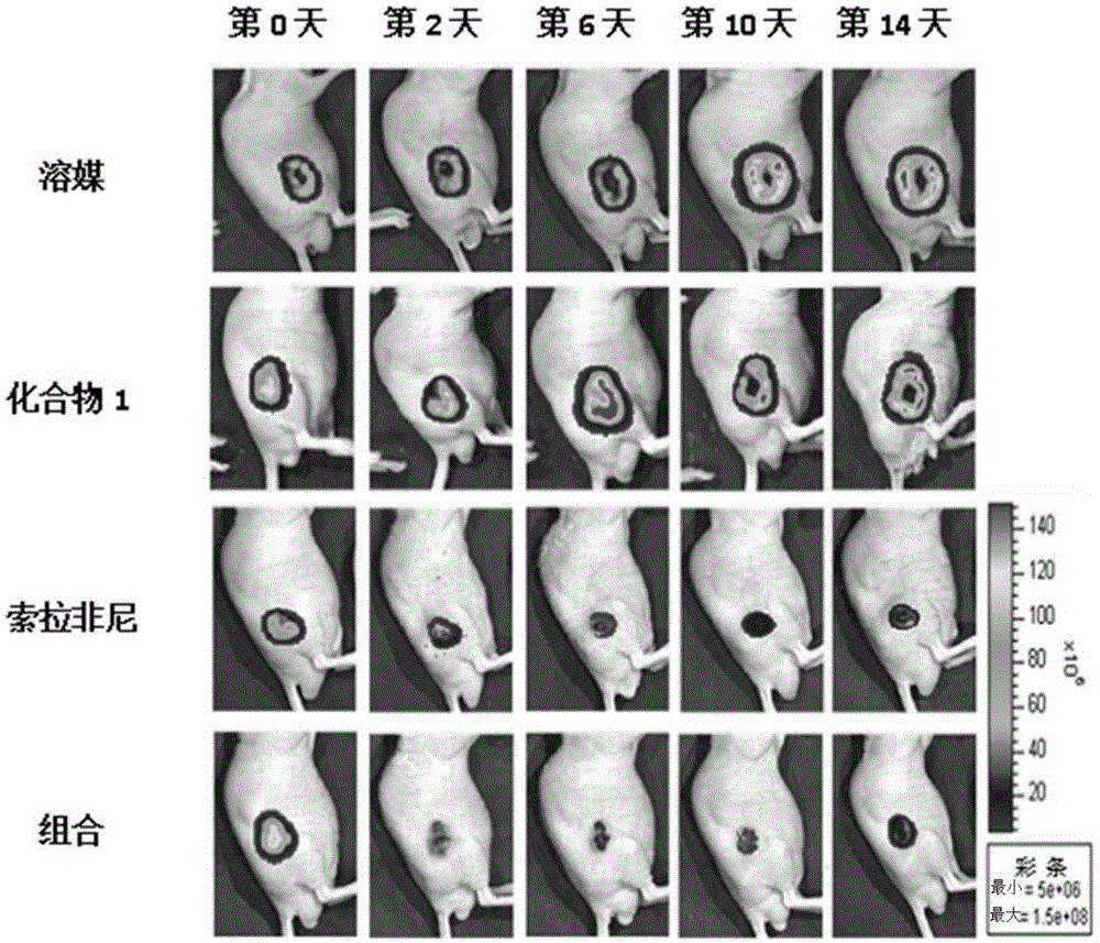 包含血管破坏剂的用于治疗肝癌的组合物的制作方法