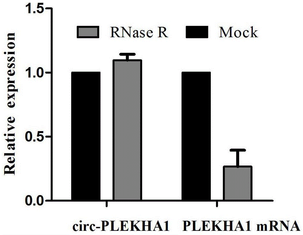 血液中circ-PLEKHA1分子标志物在诊断食管鳞癌中的应用的制作方法