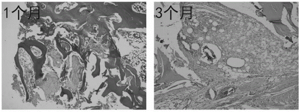 一种生物型骨修复材料及其制备方法与流程