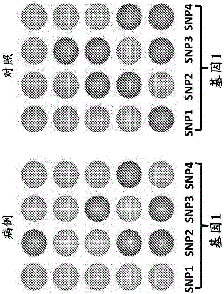 基于基因的炎性肠病诊断的制作方法