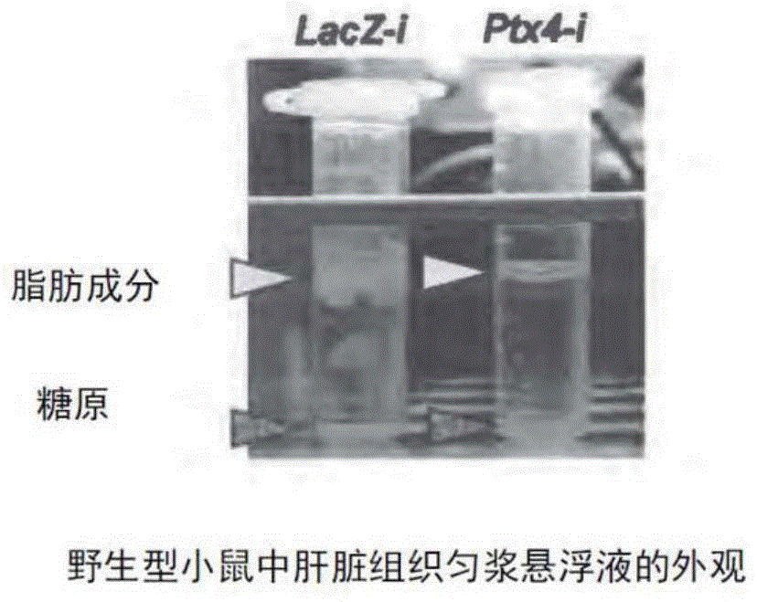 通过肝分泌代谢调节剂抑制作用的肥胖相关疾病的治疗剂的制作方法