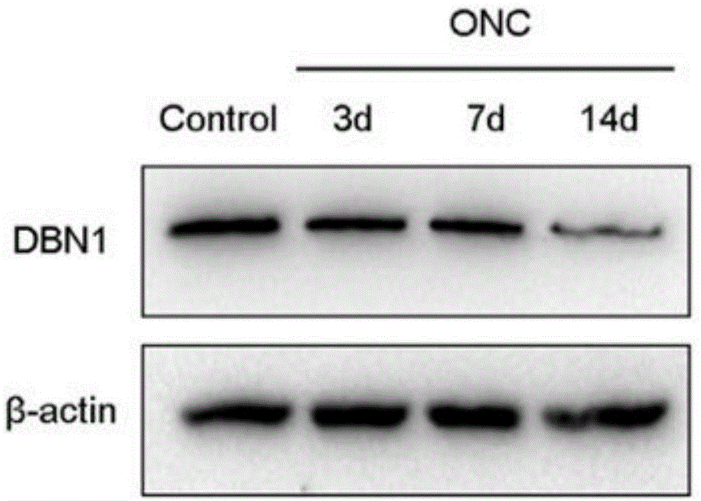 DBN1蛋白在制备神经变性疾病诊断药物中的应用的制作方法