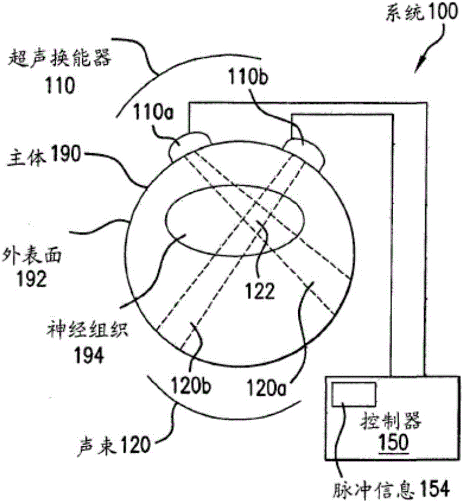 使用超声用于调节细胞活性的方法和装置与流程