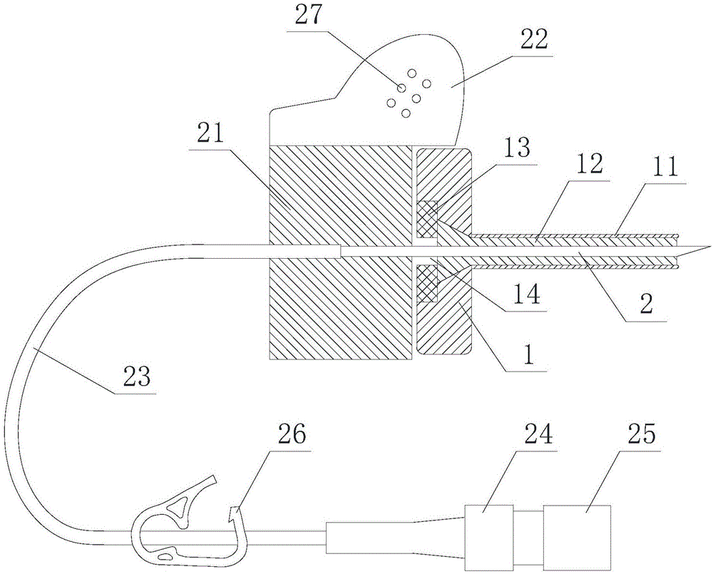 留置扣眼钉的制作方法