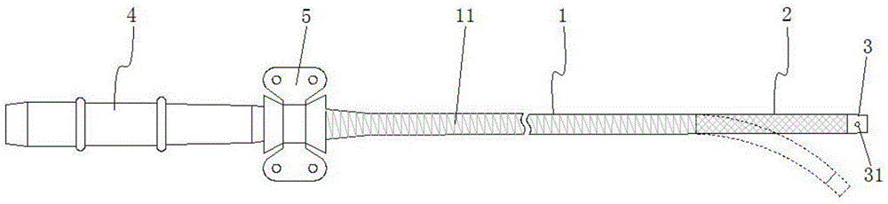 一种具有金属网管的静脉插管的制作方法