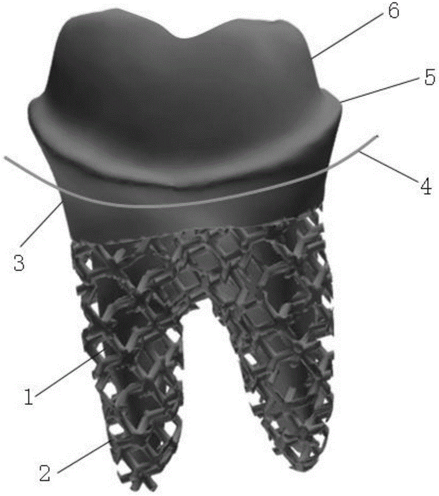 一种3D打印多孔根形种植牙的制备方法与流程