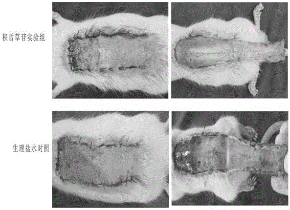 积雪草苷在促进缺血超长随意皮瓣存活的作用的制作方法