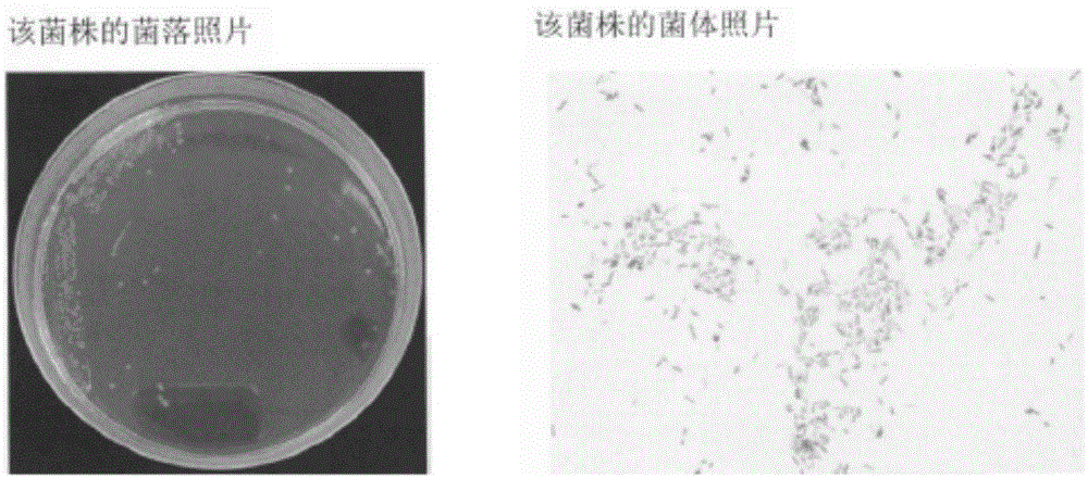 涉及一种防治猕猴桃疫霉病的侧孢短芽孢杆菌及其菌剂的制备方法