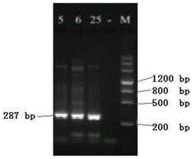 一种检测TRIM29基因Tyr544Cys突变的试剂盒及其用途的制作方法