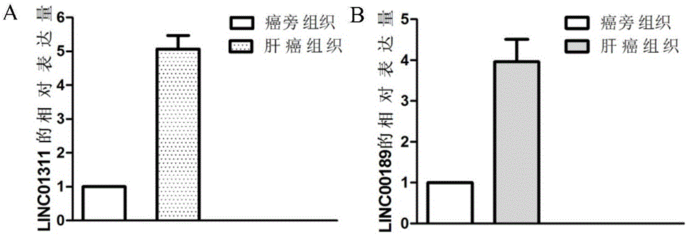 一种与肝癌相关的长链非编码RNA及其应用的制作方法