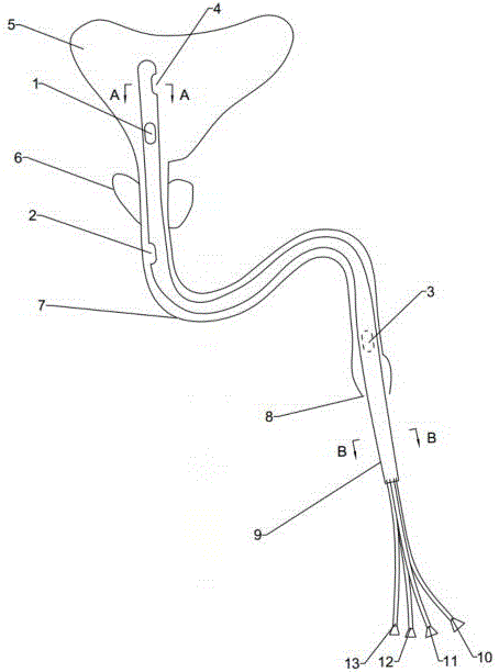 一种尿道测压管、测压装置及流体形态阻力测量装置的制作方法