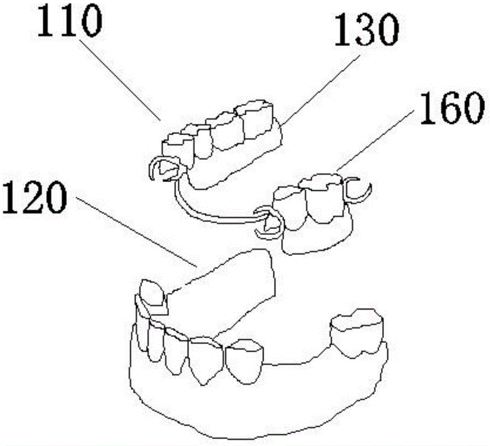 义齿三维填充护理造型的制作方法