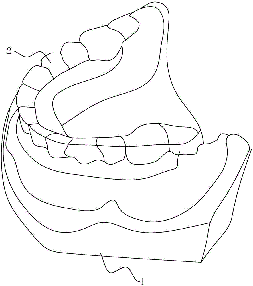 一种义齿展示模型的制作方法