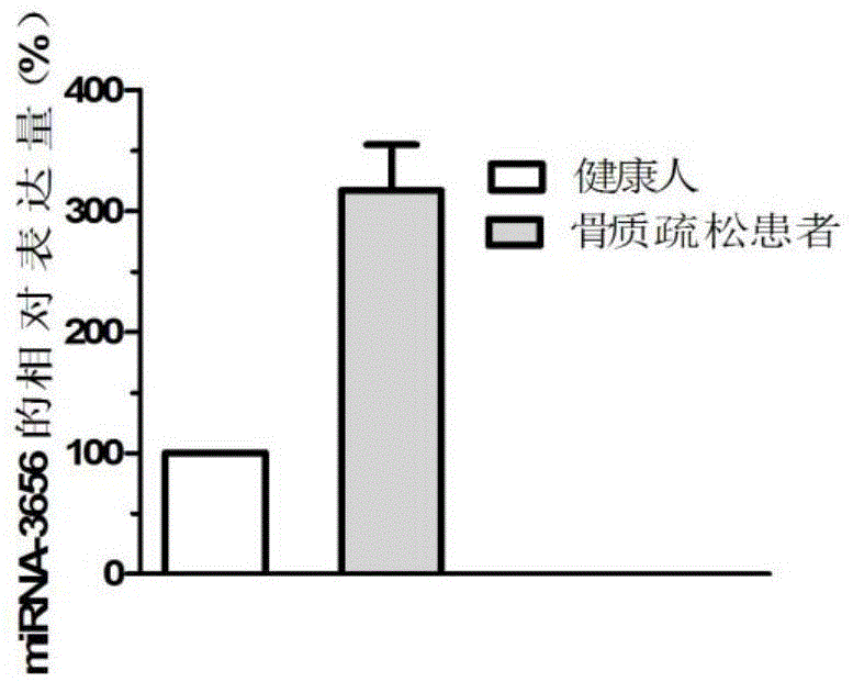 绝经后骨质疏松的诊疗标志物的制作方法