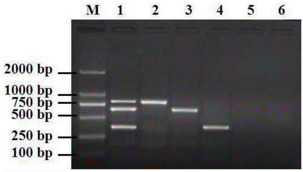 一种猪病原体的多重PCR检测方法与流程