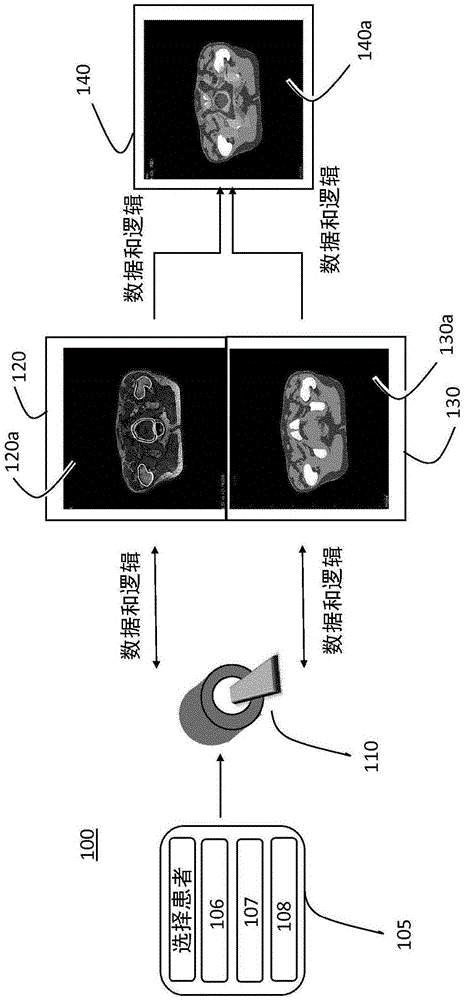 被配置为用于基于图像的放射治疗规划的医学产品的制作方法