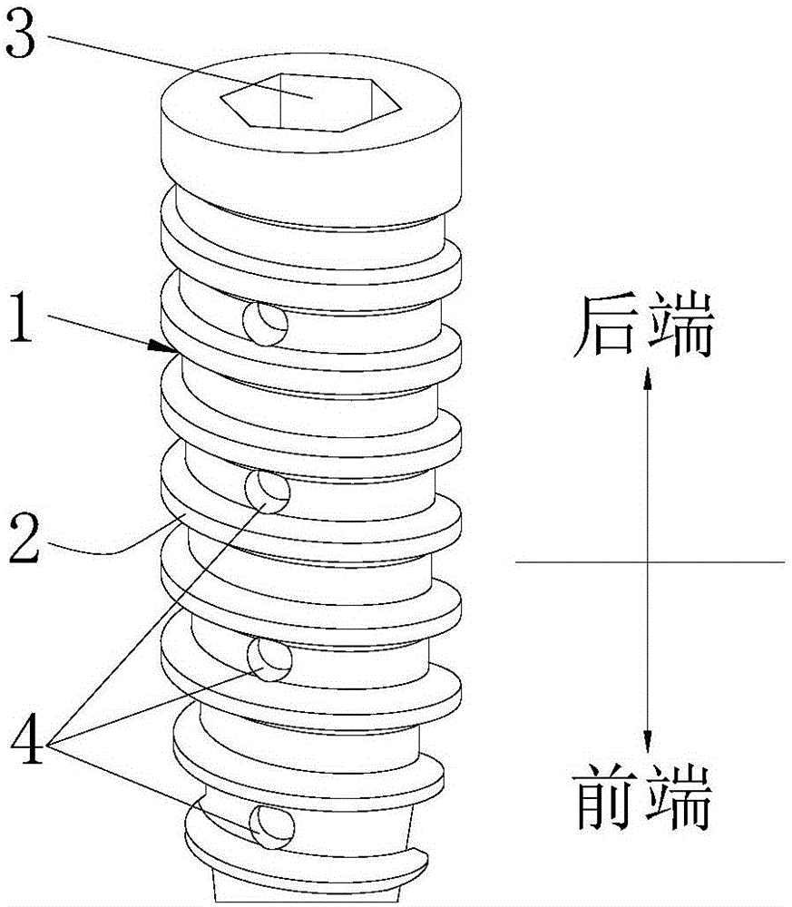 一种旋入式带线锚钉的制作方法