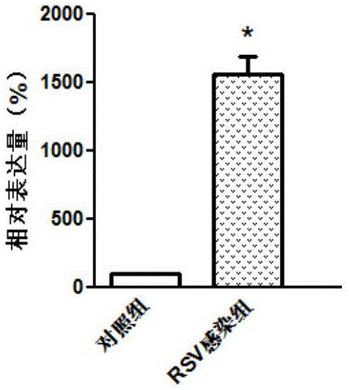 检测呼吸道合胞病毒感染的分子标志物-TXN基因及其表达产物的制作方法