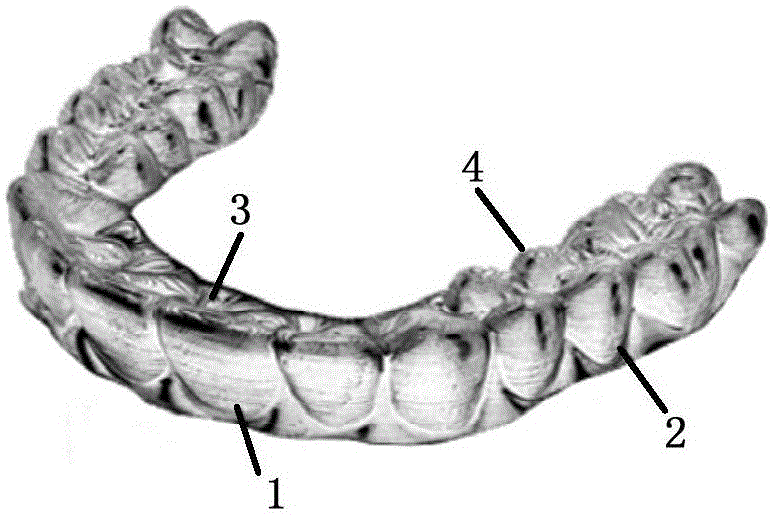 生物友好型口腔正畸矫治器的制作方法
