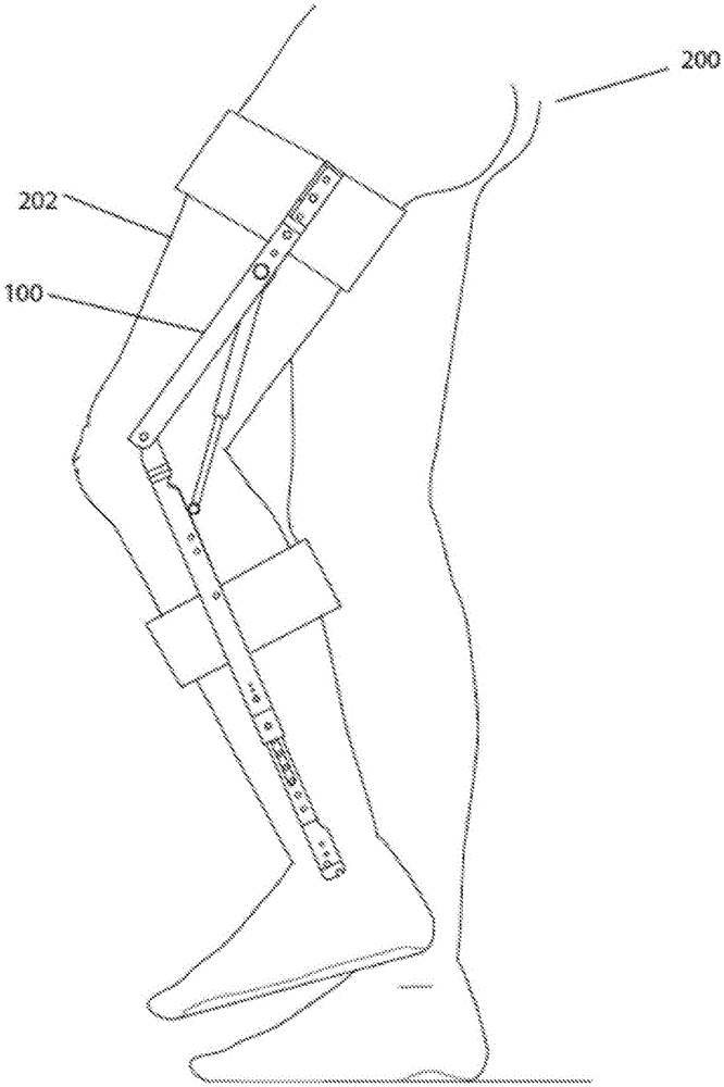 腿部支撑外骨骼的设计和用途的制作方法