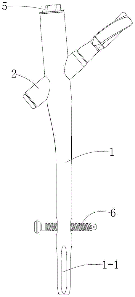 股骨髓内钉的制作方法