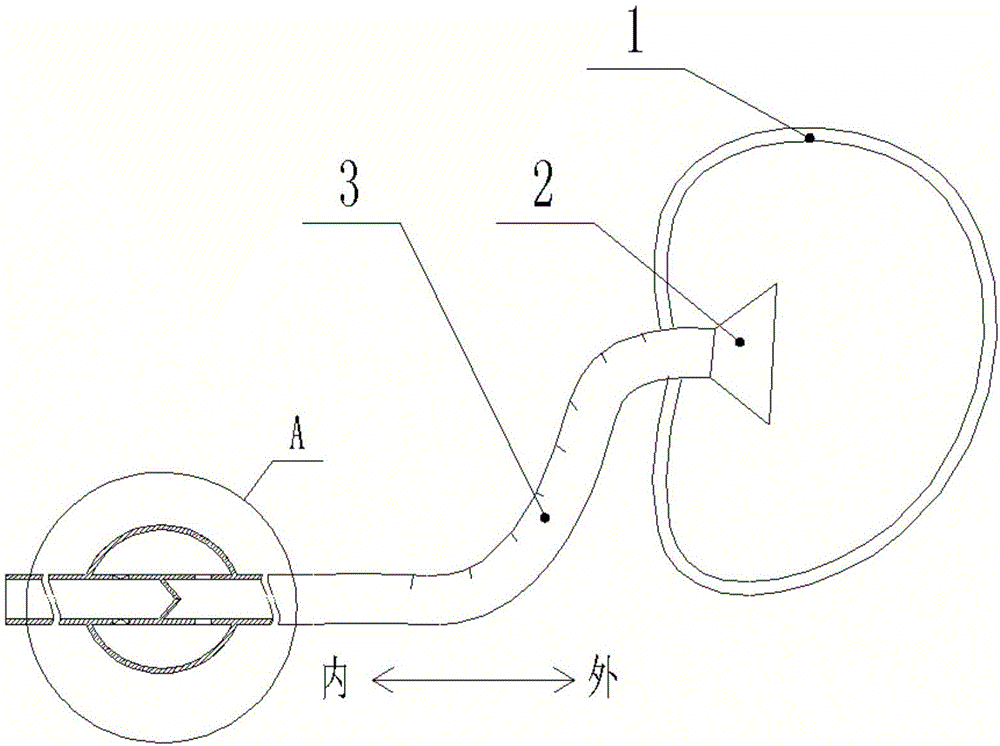 一种消化内科用洗胃管的制作方法